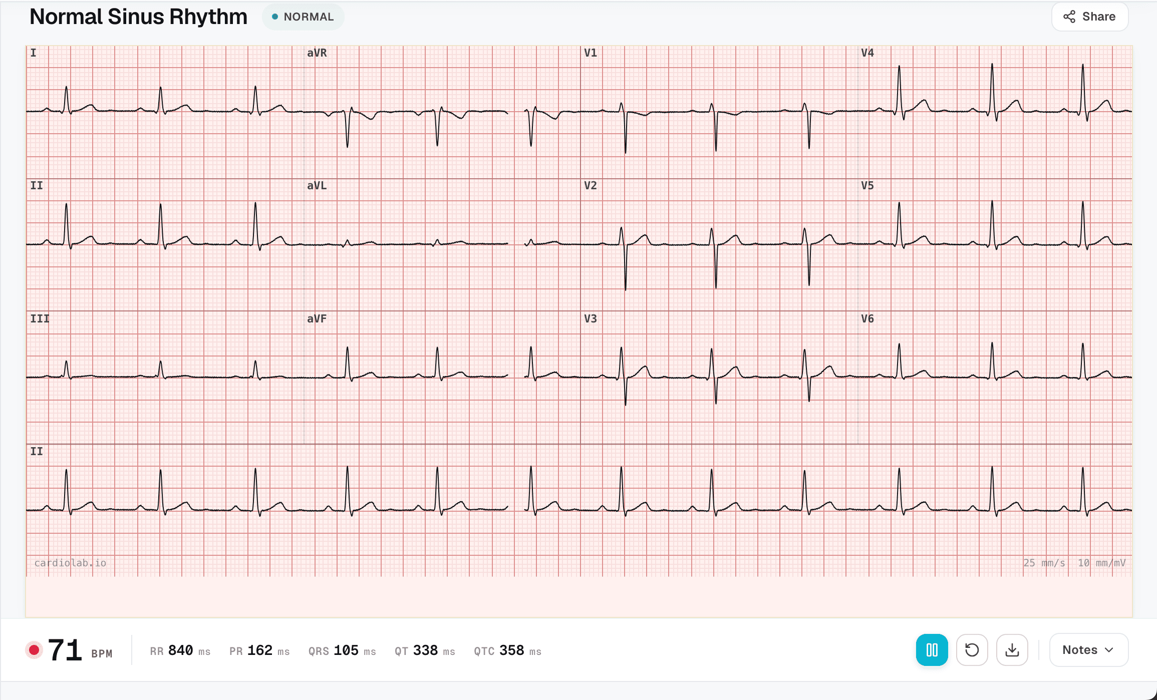 CardioLab ECG simulator interface showing a live Lead II rhythm strip with real-time HR, PR, QRS and QT measurements